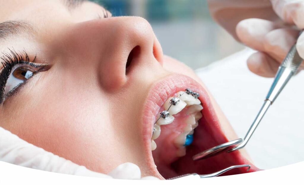 ¿la ortodoncia suelta dientes? te lo explicamos en Oh My Dent